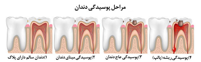 ترمیم tarmim2 1 - ترمیم