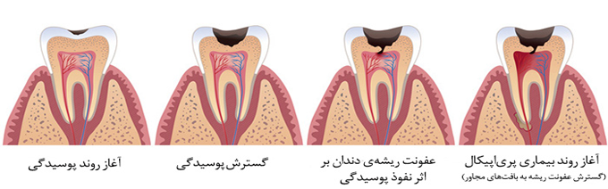 ترمیم tarmim3 - ترمیم