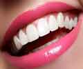 طرح لبخند-اصلاح طرح لبخند درمشهد-دکترمجیدقیاسی بهترین دندانپزشک زیبایی درمشهد